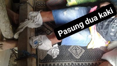 Kasus Pasung Baru di NTT Masih Saja Terjadi