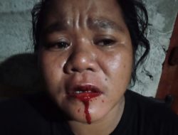 Aniaya Istri Orang, Ketua RT 008 Dilaporkan Ke Polisi